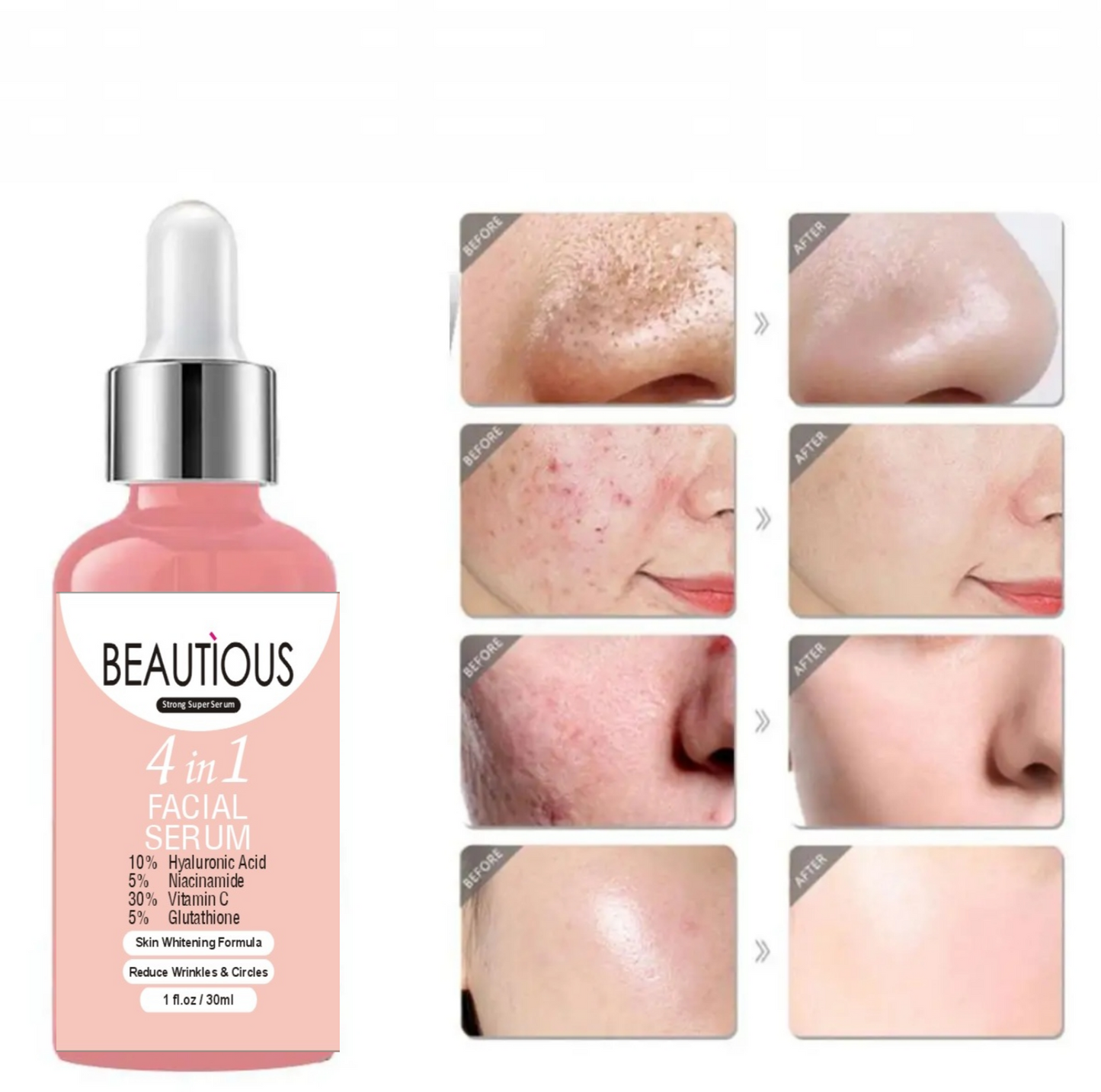 Skinkit Vitamin C  Serum with Niacinamide & Hyaluronic Acid